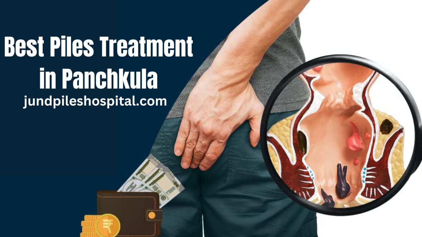 Best Piles Treatment in Panchkula