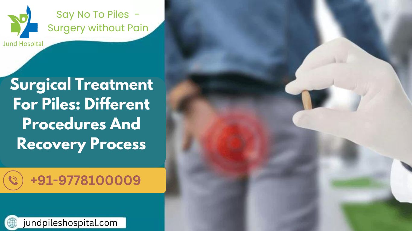 Surgical Treatment For Piles: Different Procedures And Recovery Process